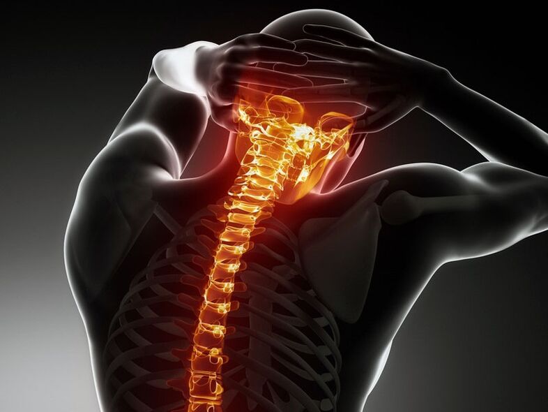 أعراض هشاشة العظم