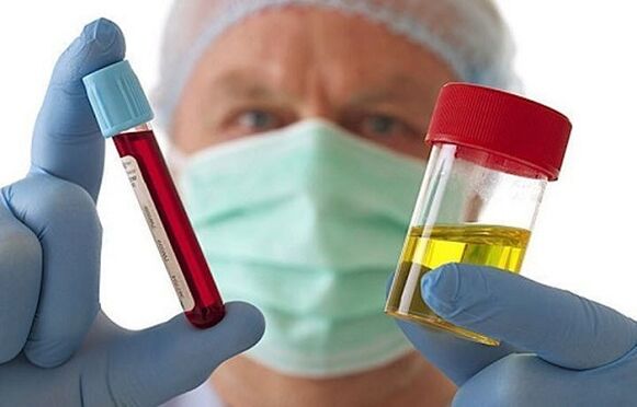 طرق لتشخيص هشاشة العظم من عمود عنق الرحم